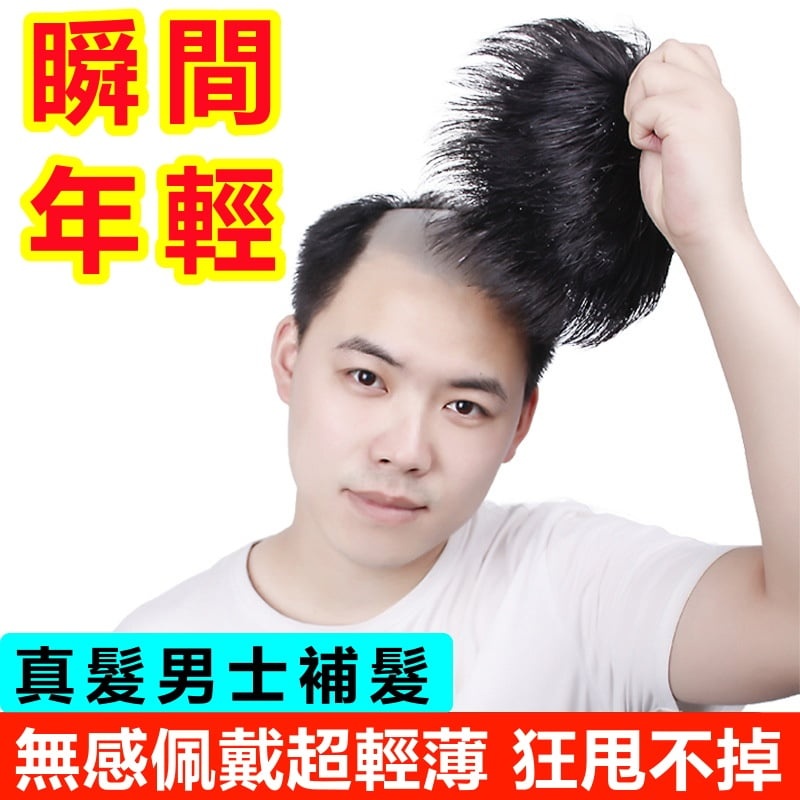 男士補髮